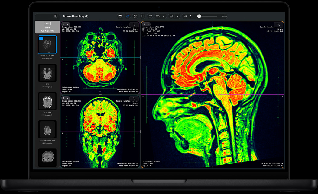 Pantalla de una MacBook Pro que muestra la app Falcon MD